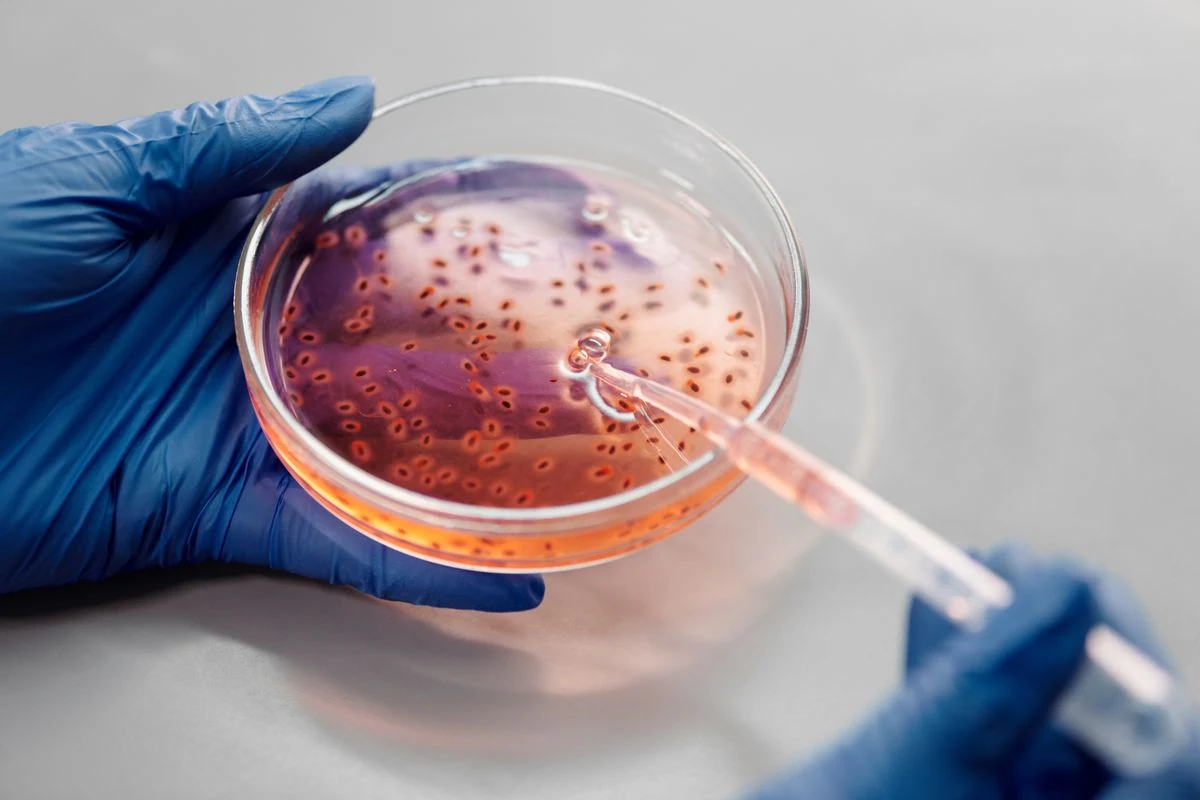 Petri dish with engineered bacteria colonies being sampled